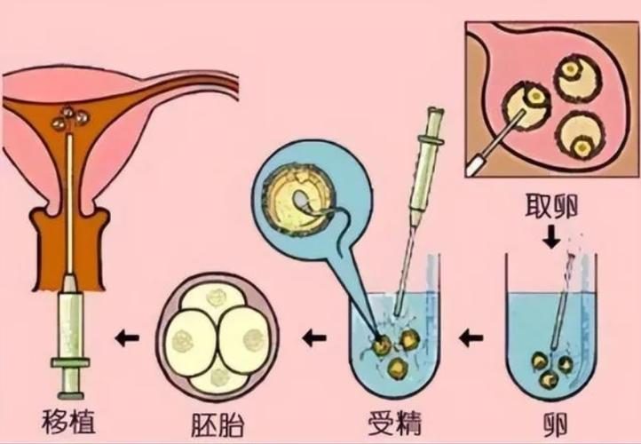 中国有供卵试管婴儿吗-中国是否允许供卵试管婴儿？