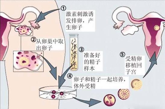 国内怎么供卵-国内供卵方式详解